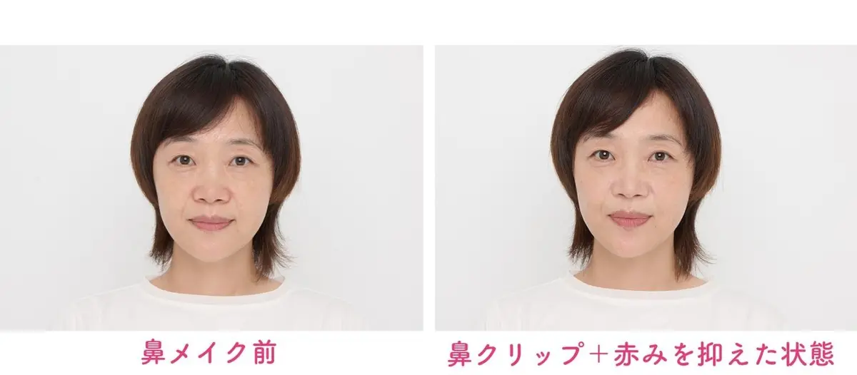 OurAge×Webエクラ 鼻クリップでむくみすっきり。
