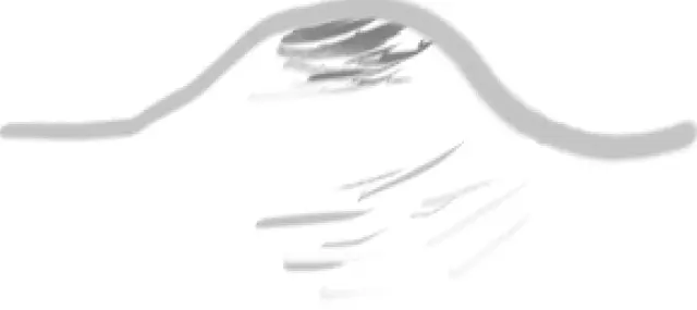 色素性母斑（ほくろ）