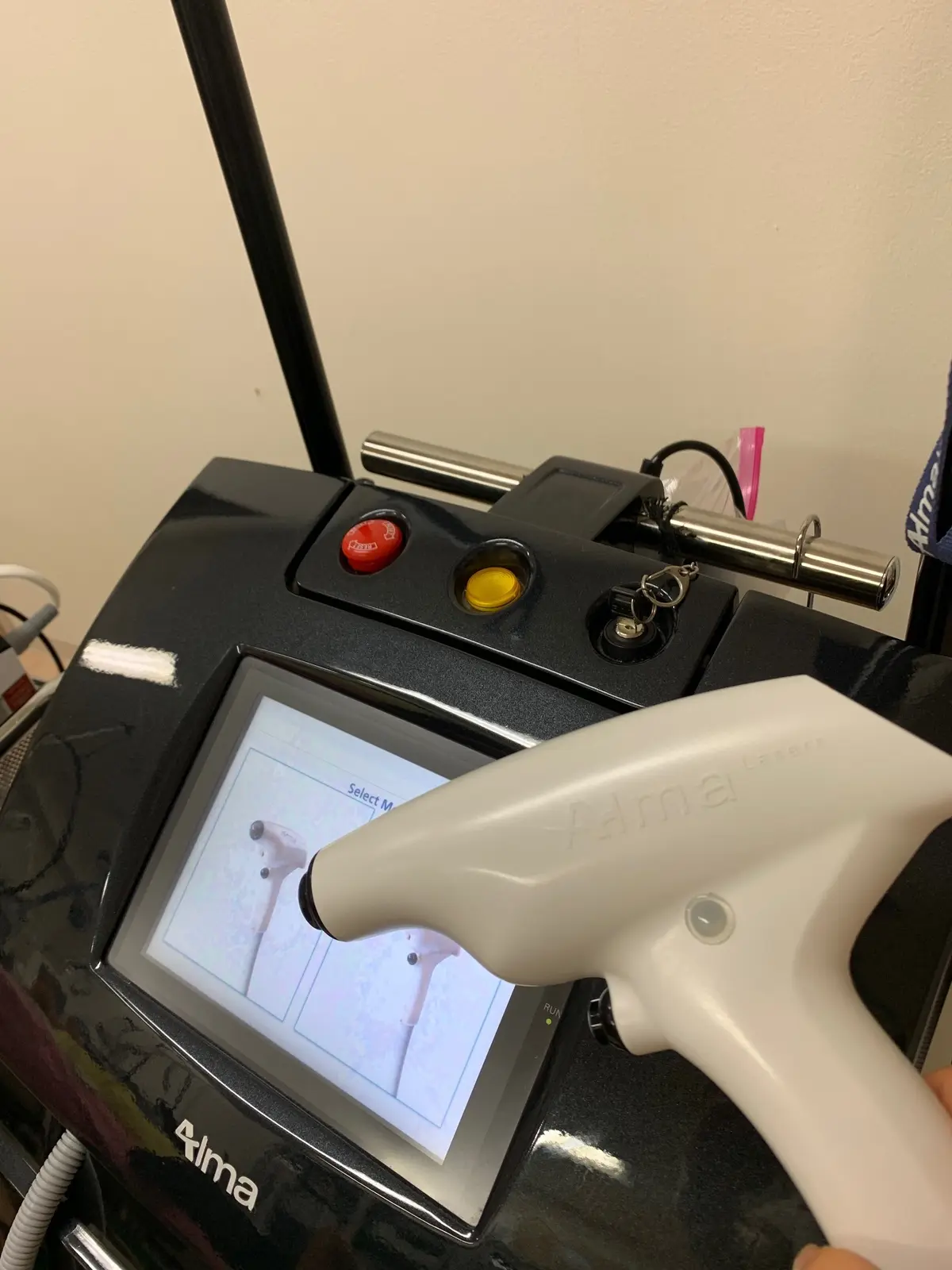 テノール　美容　美容外科　高周波