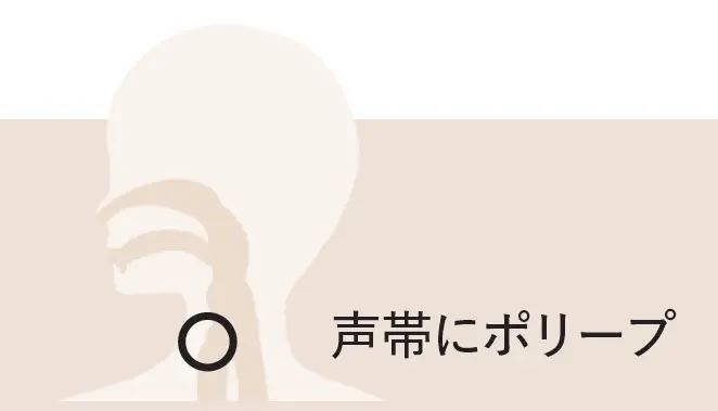 鼻・喉からくる不調の原因は？「副鼻腔炎、の画像_5