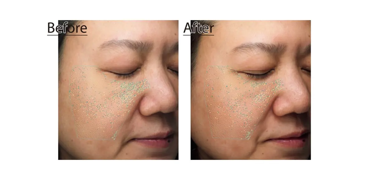 詰まり毛穴にお悩みのJマダムが3週間チャレンジ