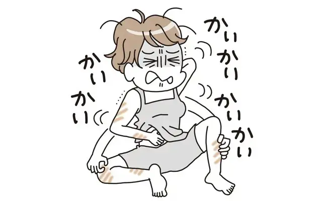 原因不明のかゆみが大発生！ かいても止まらず、どうしたら!?
