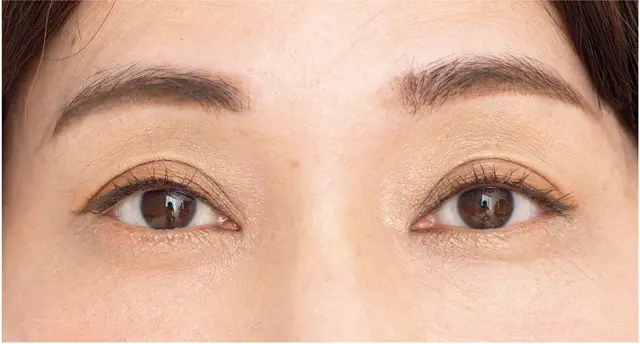 下がり二重をラインで断ち切り、明るめカラーでふっくらと