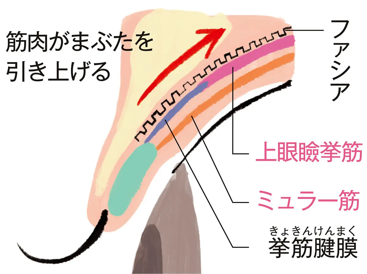 OurAge×Webエクラ　眼瞼下垂症