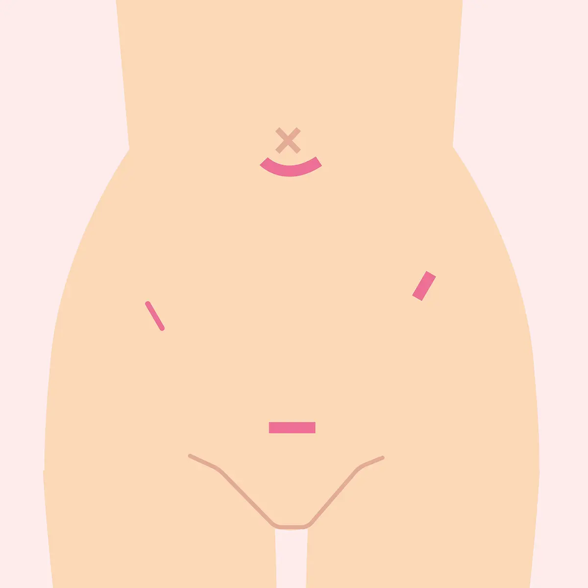 OurAge×Webエクラ　お腹の傷あと／イラスト