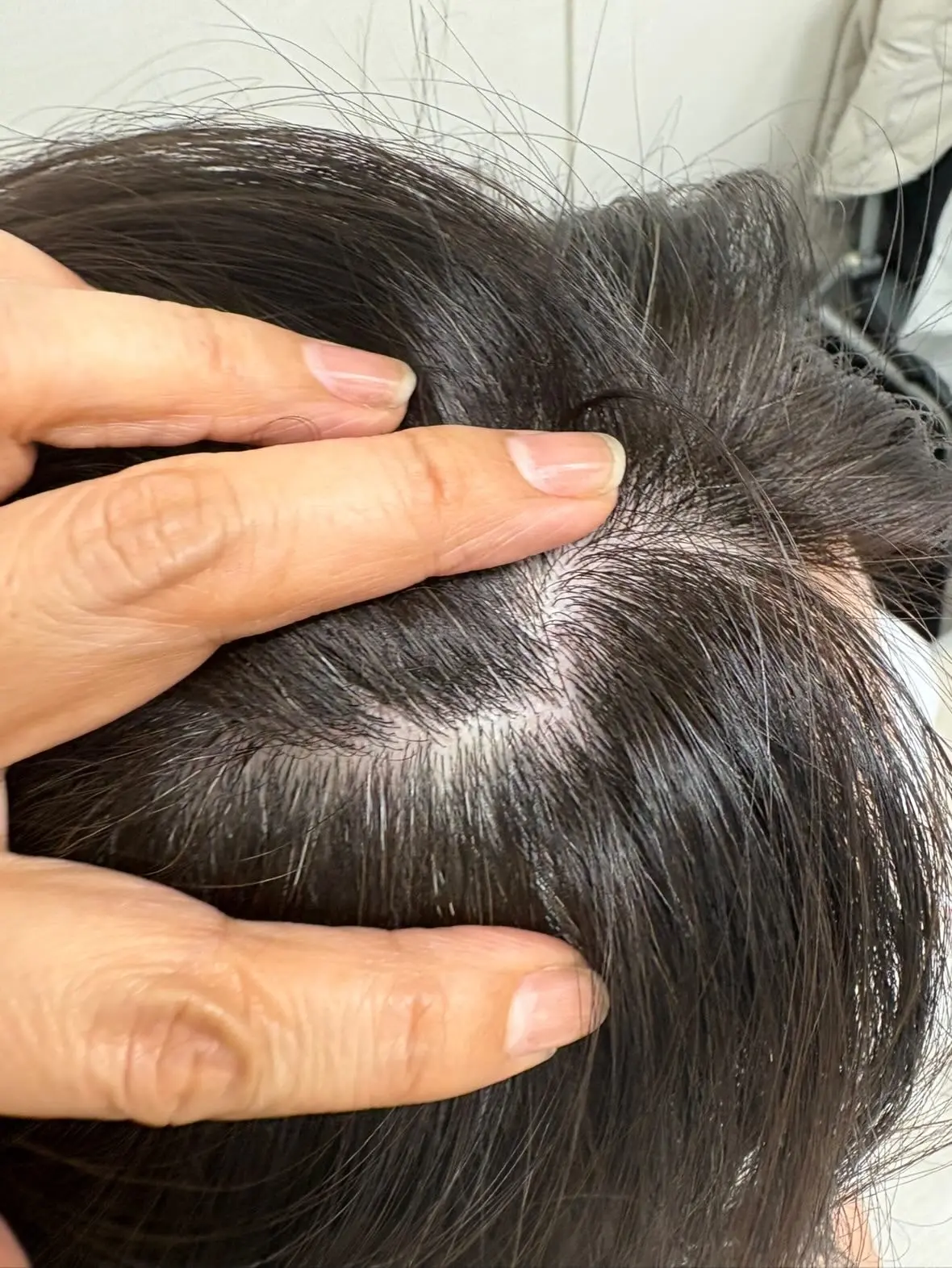 【エクラ美髪プロジェクト】2週間お試しでの画像_2