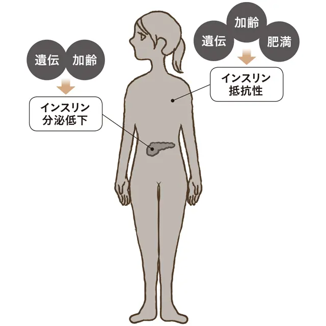 高血糖になる原因とインスリンの関係