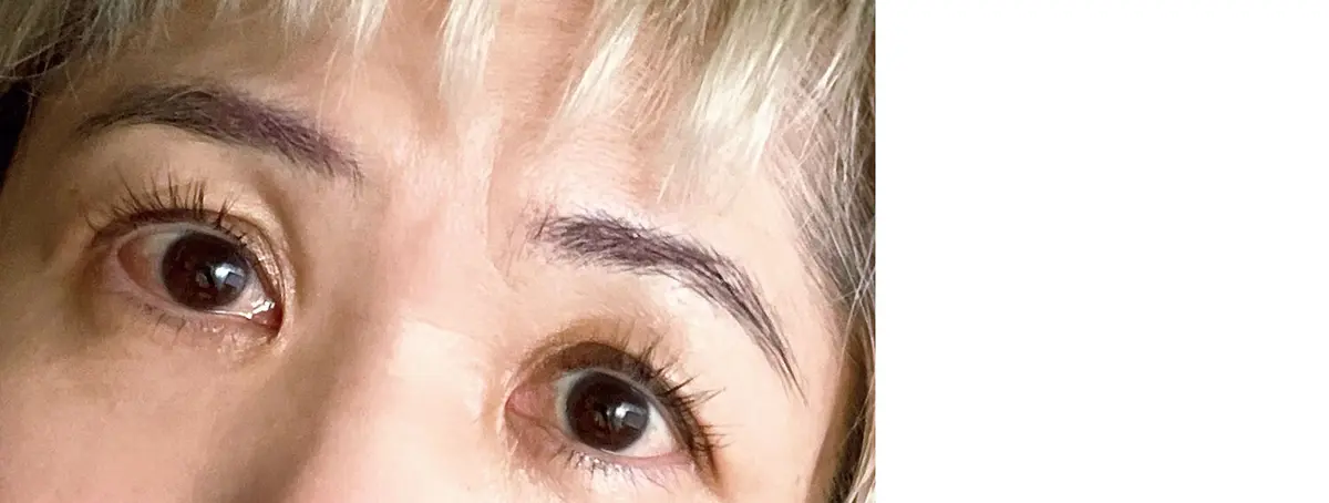 OurAge×Webエクラ　ライター蓮見則子は「隠れ眼瞼下垂」でした