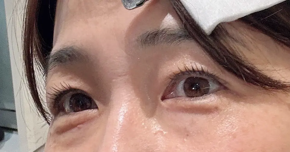 目の周りのシワ、なかったことに❗️の画像_4