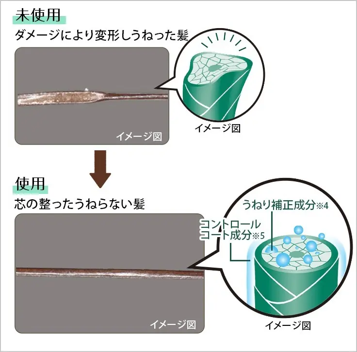 コルコアセット技術