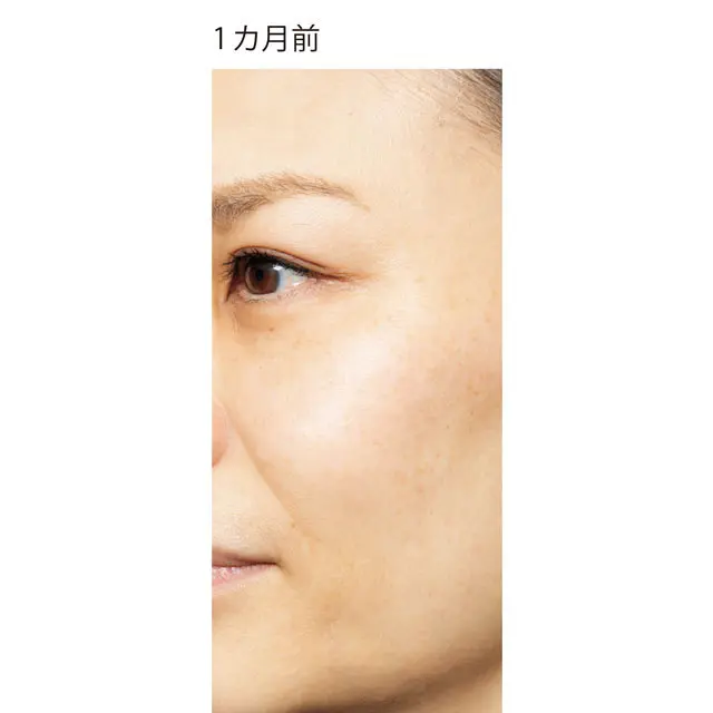1ヶ月前の肌の様子