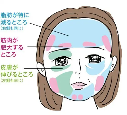 OurAge×Webエクラ　青い部分＝脂肪が特に減るところ（左右とも同様）  ピンクの部分＝筋肉が肥大するところ  緑の部分＝皮膚が伸びるところ（左右とも同様）