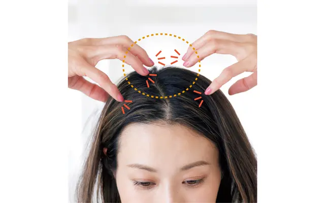 抜け毛・薄毛を解消！2