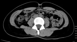 OurAge×Webエクラ　AFTER -2