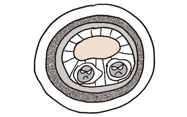 コレステロール値急上昇