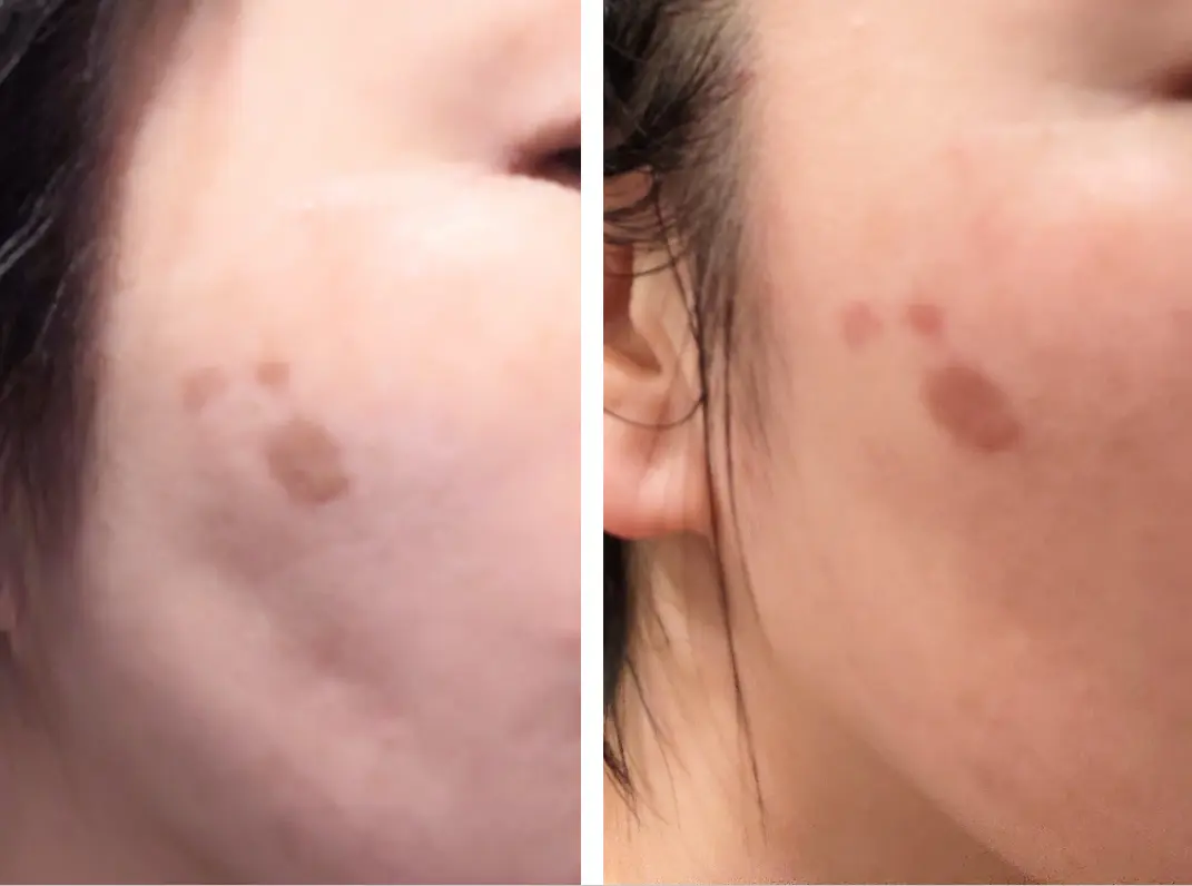 シレッとシミメンテ！お正月休みで大成功♡の画像_2