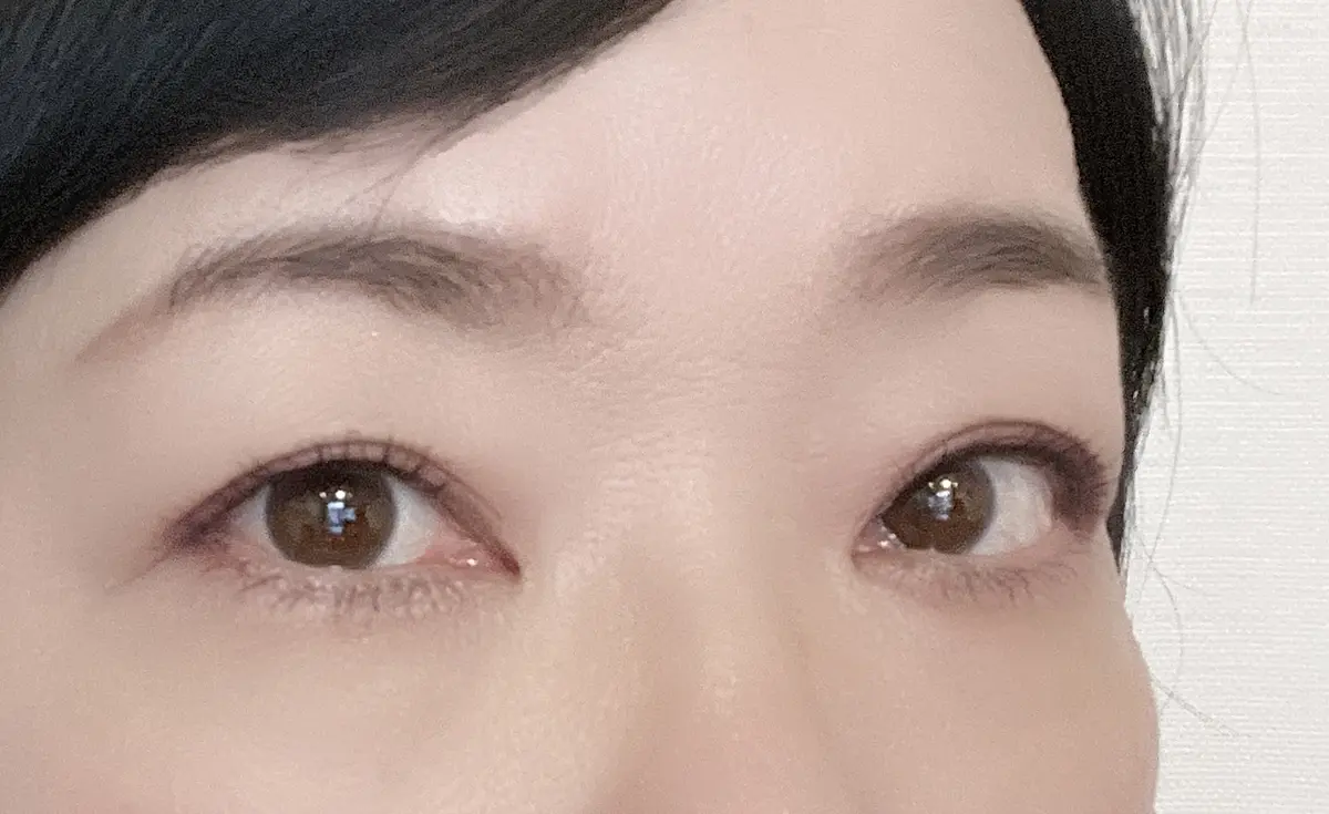 両目　アフター