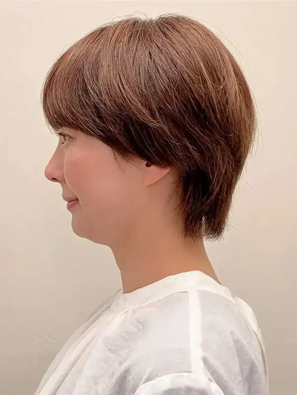 before写真　横