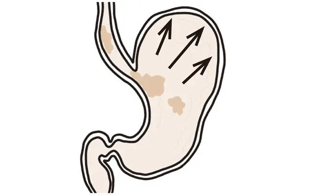 正常な胃の動き①《 ためる 》