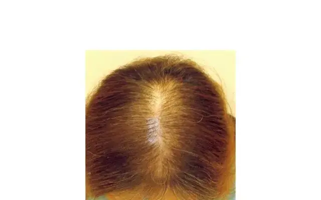 【50代の「頭皮ケア」】薄毛対策もバッチの画像_34