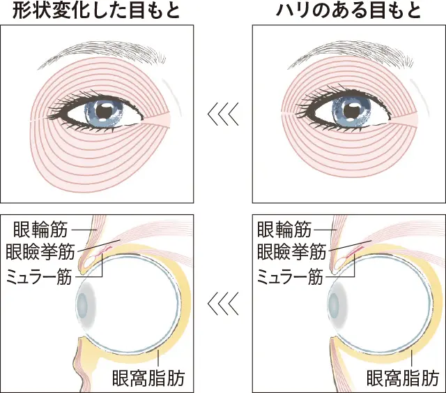 アラフィーの「眼輪筋」に起こっていること