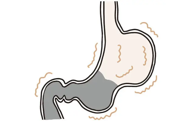 自律神経が乱れると