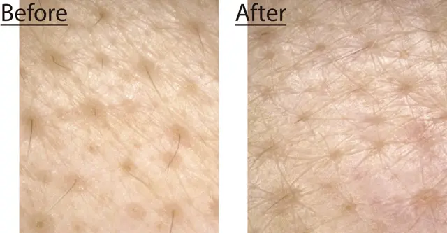 たるみ毛穴にお悩みのJマダムが3週間チャレンジ