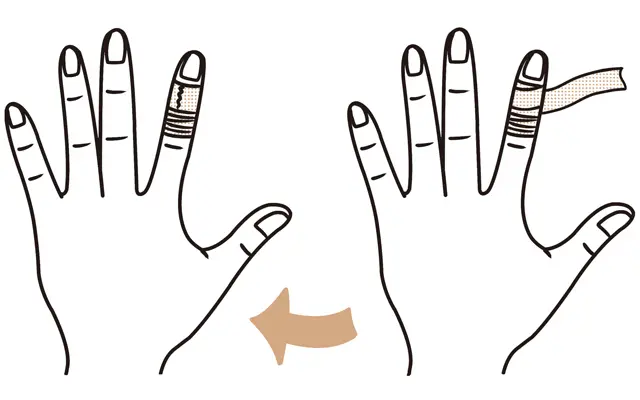 ぐるぐるテーピング