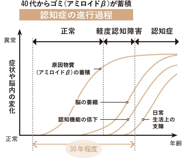 認知症の進行過程