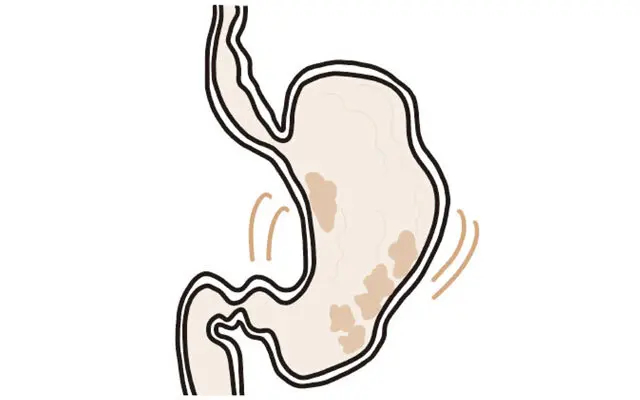 正常な胃の動き②《混ぜる》