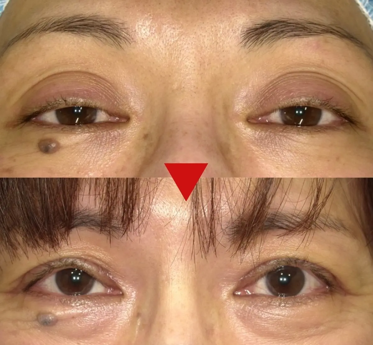 OurAge×Webエクラ　高田先生の症例