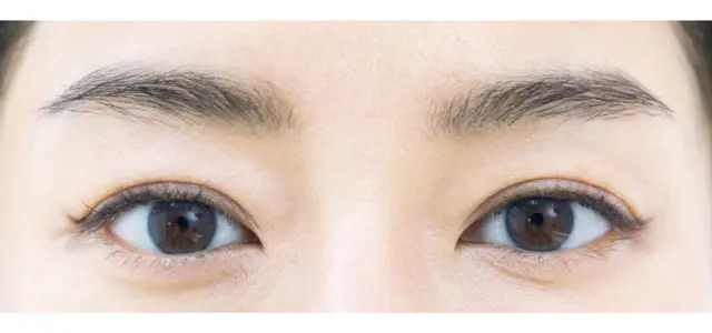 “引き上げライン”