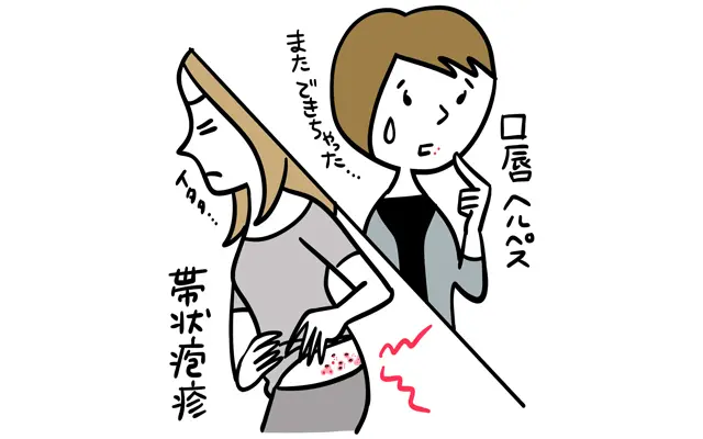 Q.ヘルペスと帯状疱疹の違いは？