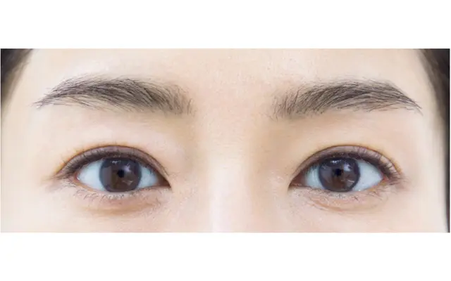 “引き締めライン”