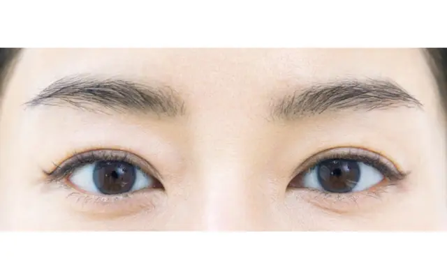 引き上げ活力アイライン