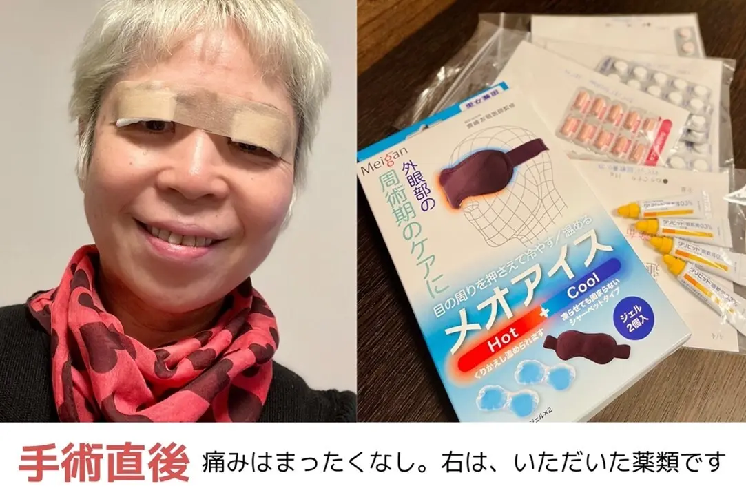OurAge×Webエクラ　手術直後　痛みはまったくなし。右は、いただいた薬類です