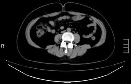 OurAge×Webエクラ　AFTER-2