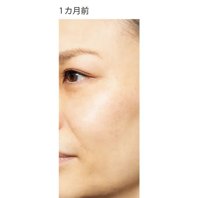 《2年経って現在》最新のセルフケアでより透明感