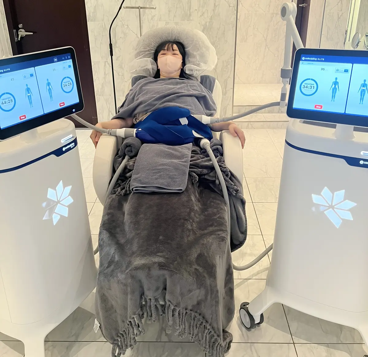 クールスカルプティング エリート　施術中