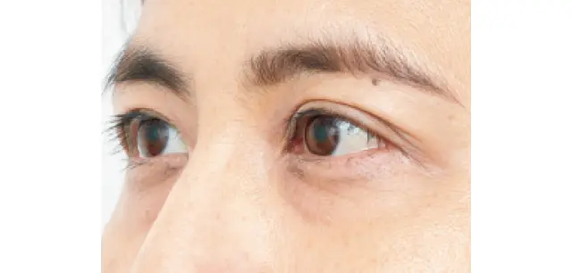 透明感が上がった目もと