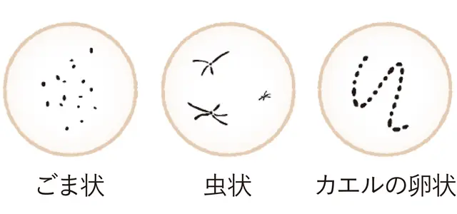 硝子体の老化によって、こんなものが見える！