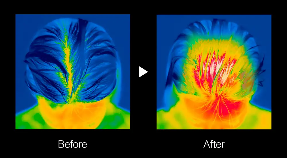 OurAge×Webエクラ  エレキブラシ　ブライト　頭　