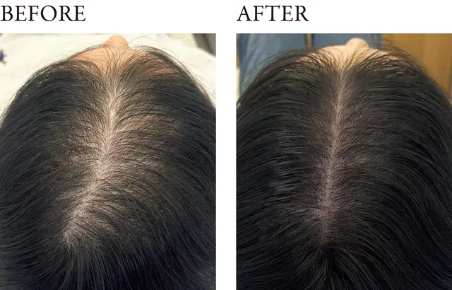 分け目のアートメイク