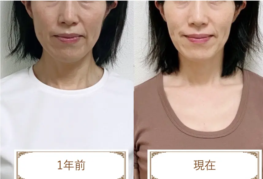 一年前と現在　before after