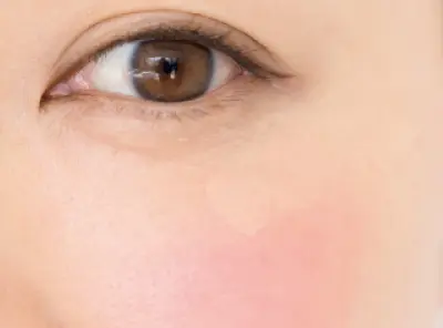 チークでくまやシミが目立つ？　チークの“の画像_3