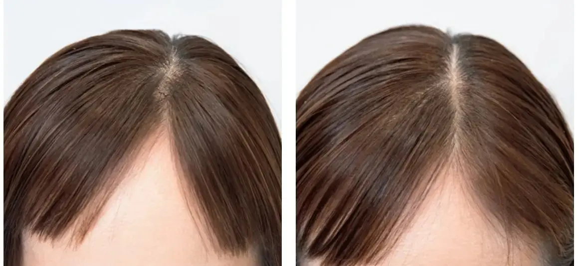 『ヘアループ』を実際に装着した感想は？