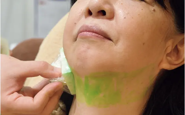 『アヴェニュー 六本木クリニック』トゥルースカルプiD（フェイス）