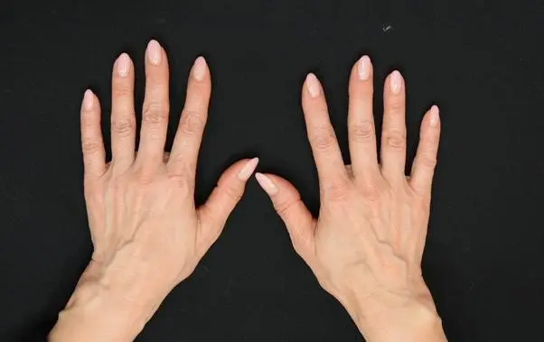 OurAge×Webエクラ  BEFORE