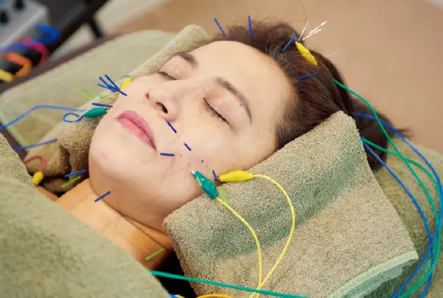 鍼にパルス電磁波を流し、効果をアップ