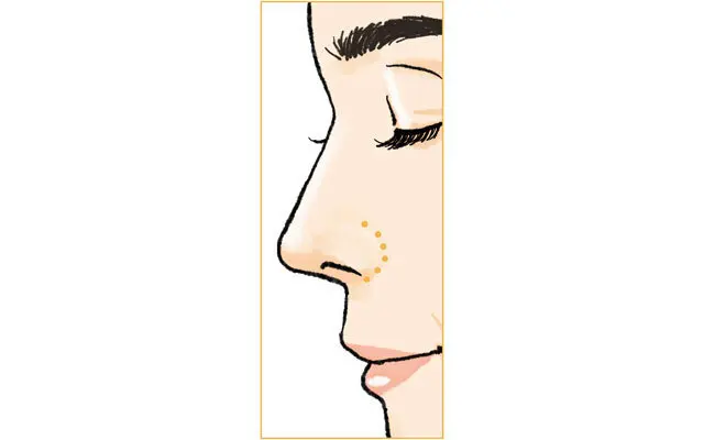 「ビタミンCコスメ」と「角栓オフコスメ」で、赤み・黒ずみをオフ